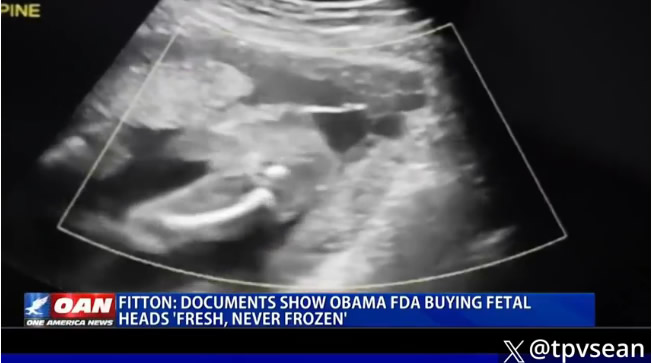 BABY BODY PARTS BEING USED TO KEEP PEOPLE&nbsp;YOUNG.